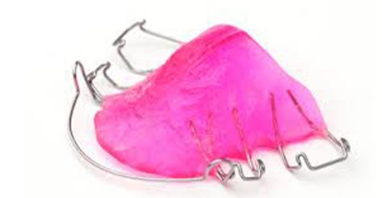 how-do-orthodontic-appliances-work-1024x576