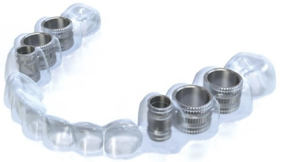 implant-template